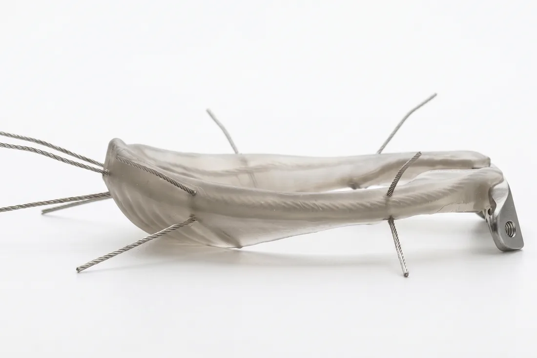 Side profile of the LunaFlex implant, showing the wedge cross-section of the composite body and the suture strands running through it.